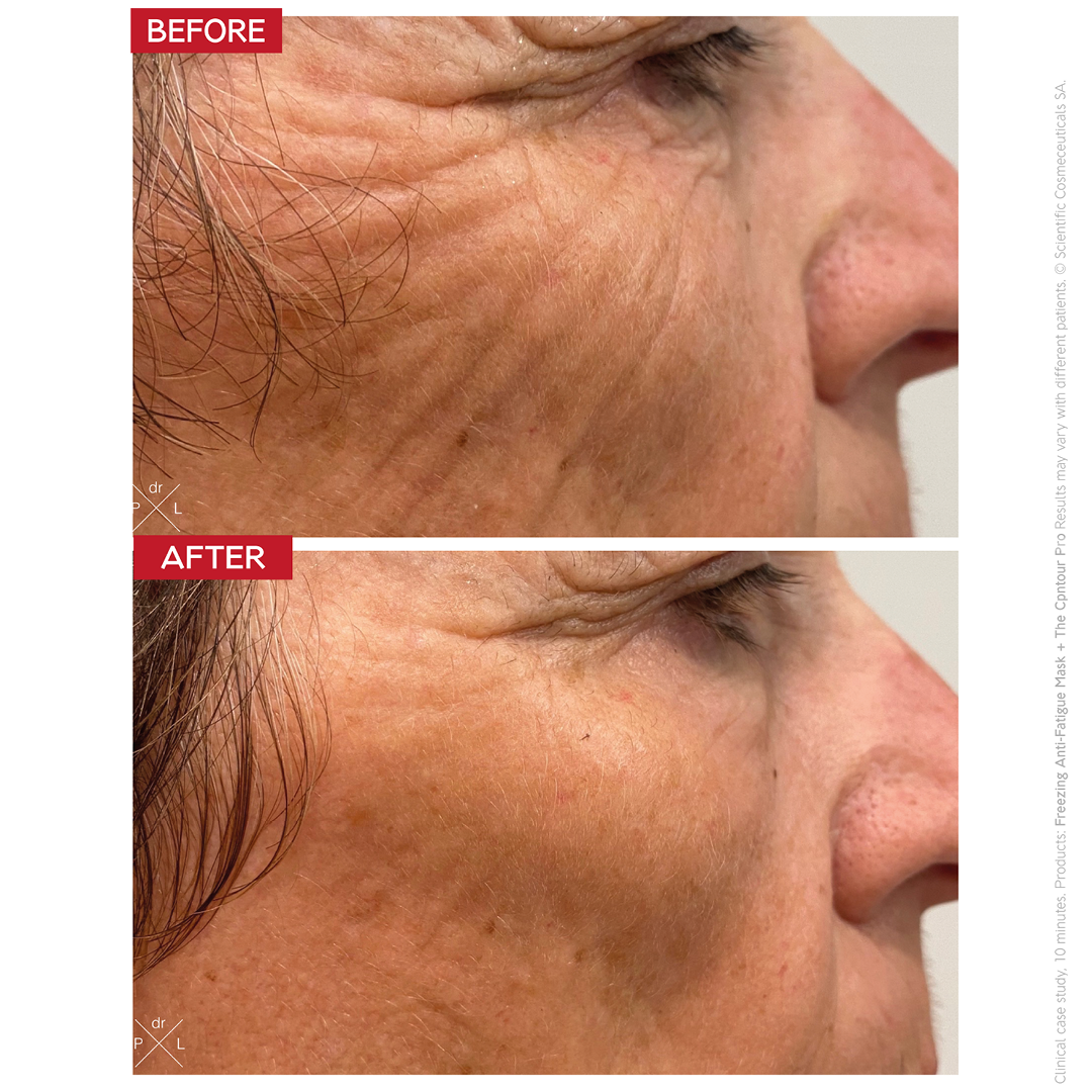 THE CONTOUR PRO