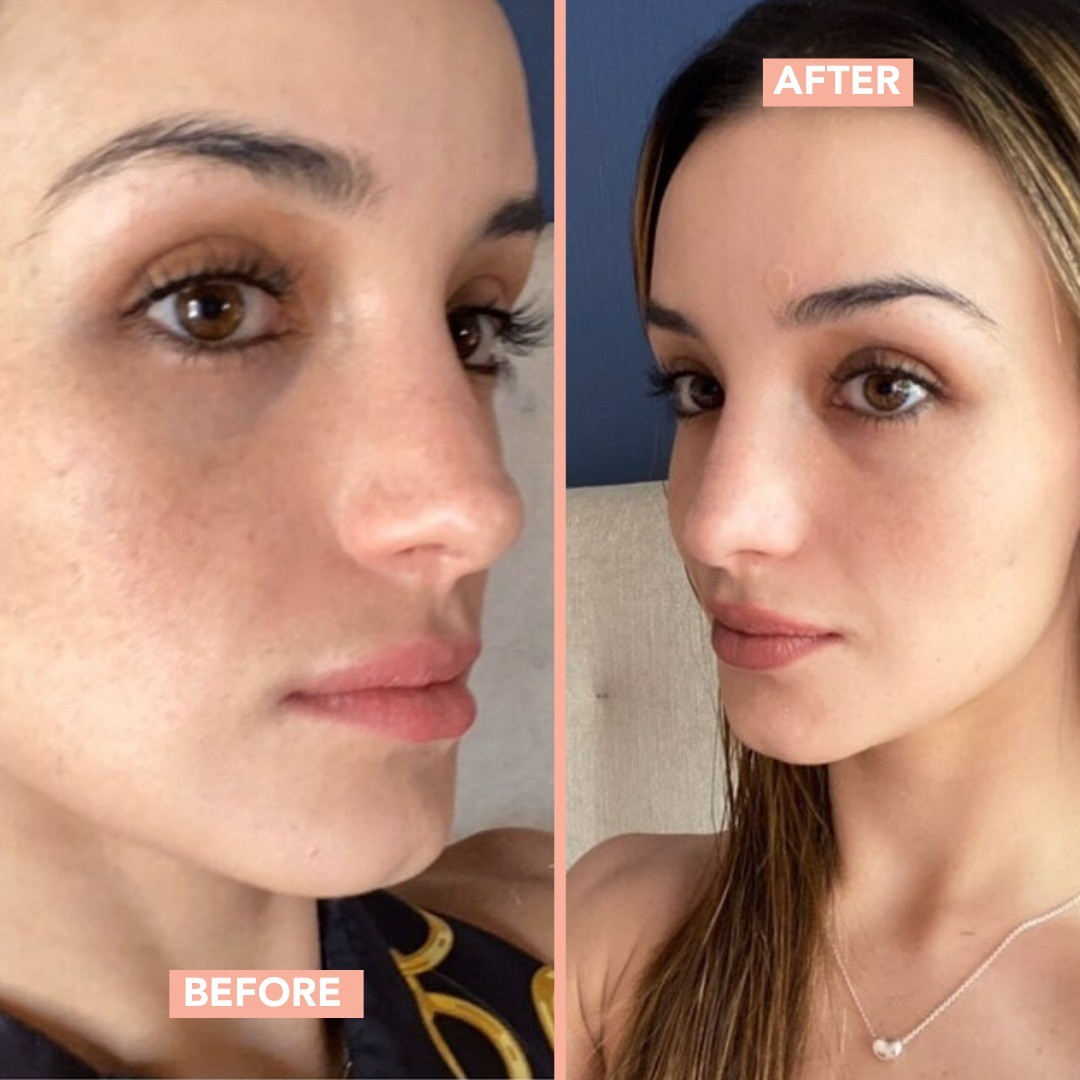 INTENSIVE SYSTEM ™