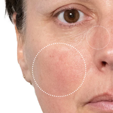 THE CREAM WITH LYMPHACTIVE